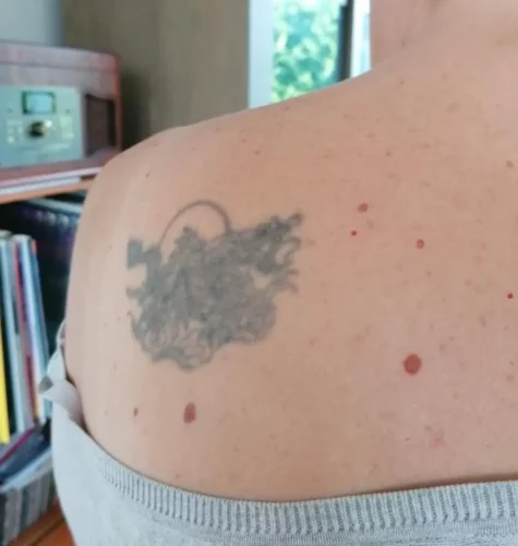 Photo d'un tatouage de dragon avant recouvrement